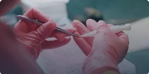 DHI_Hair_Transplant