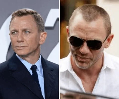 12 Male Celebrities Wear Wigs for Hair Loss