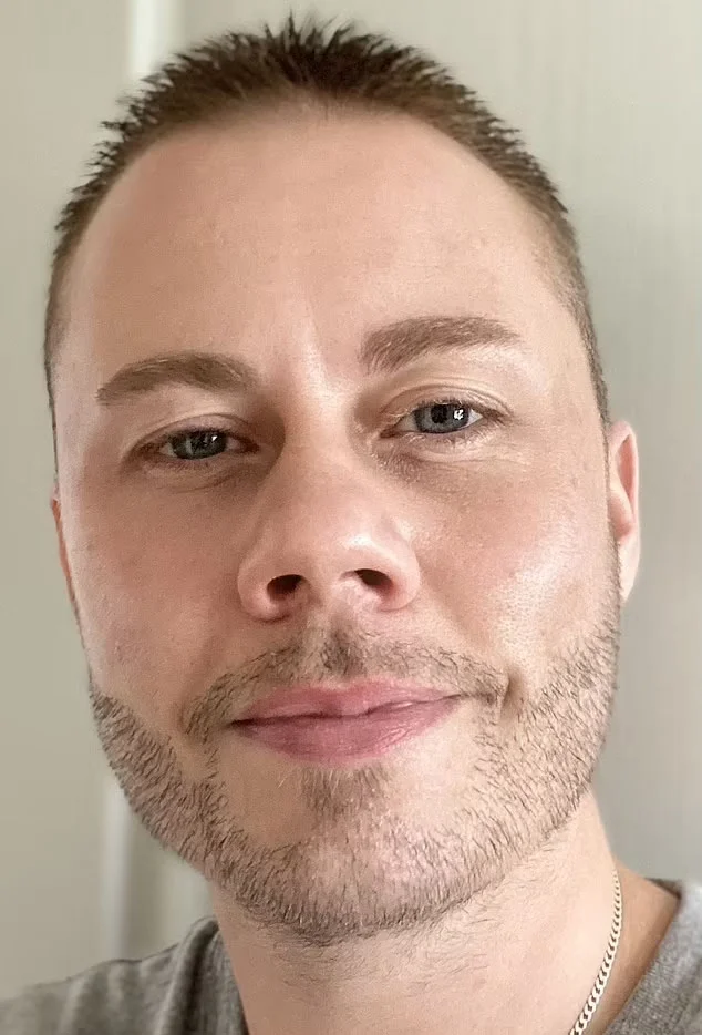 Lee Brown before his beard transplant