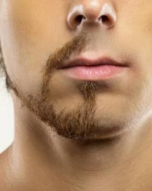 Weak beard or moustache growth