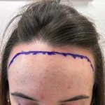 Georgia hairline planning drawing