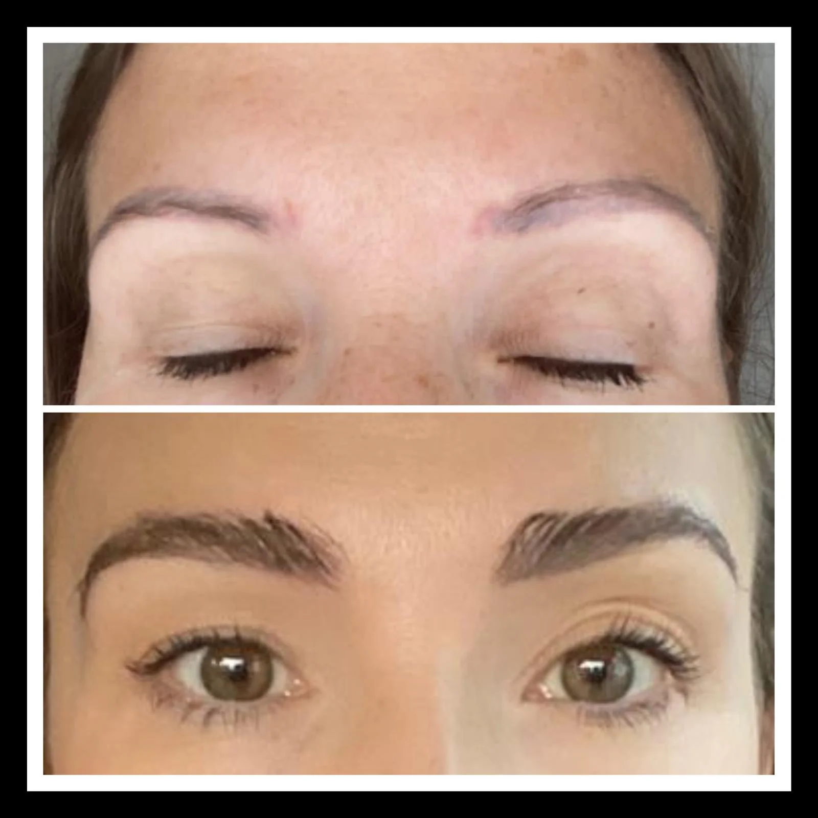 Hair transplant patient photo