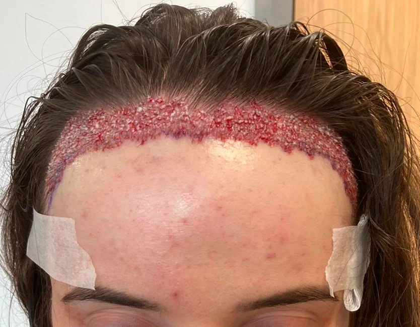Georgia’s hairline result, alternate angle
