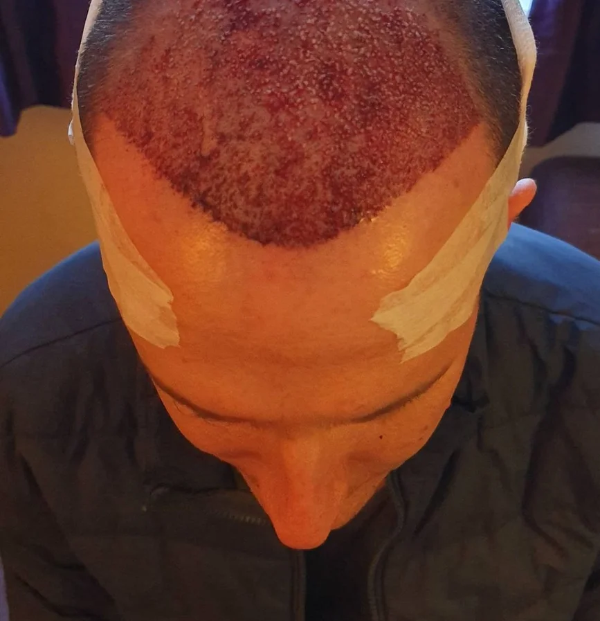 Marc after — view 1