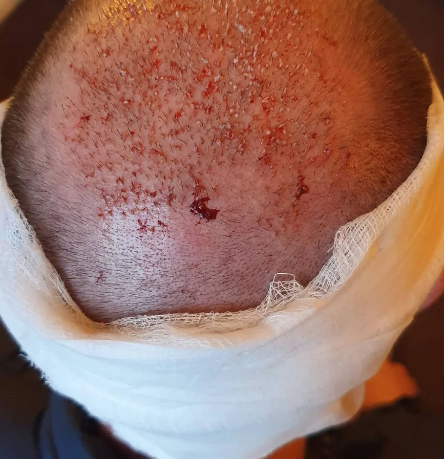 Marc after — view 2