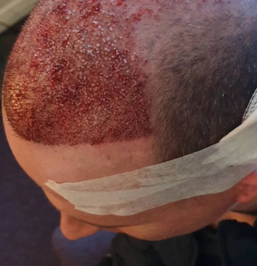Marc after — view 3
