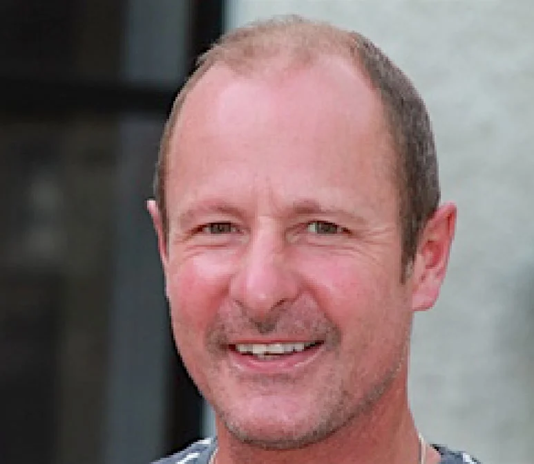 Michael Kaye after his hair transplant